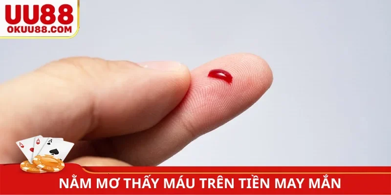 Nằm mơ thấy máu trên tiền may mắn